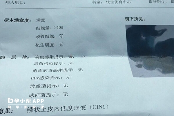 私立医院做hpv和tct检查不如公立医院好