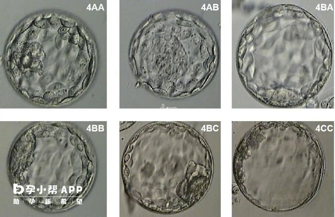 高龄试管婴儿优先考虑移植优质囊胚