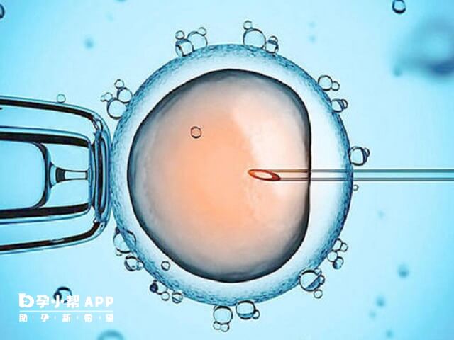 尽快做试管婴儿能保证一定的成功率