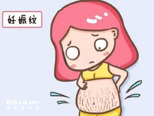 白色妊娠纹和红色妊娠纹的区别