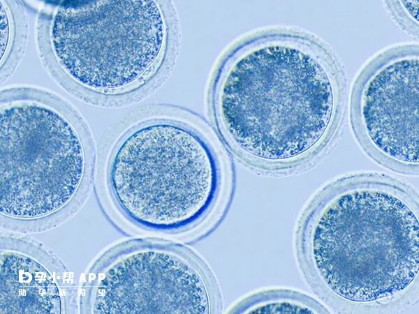 年纪大多次促排攒卵的原因是提高成功率