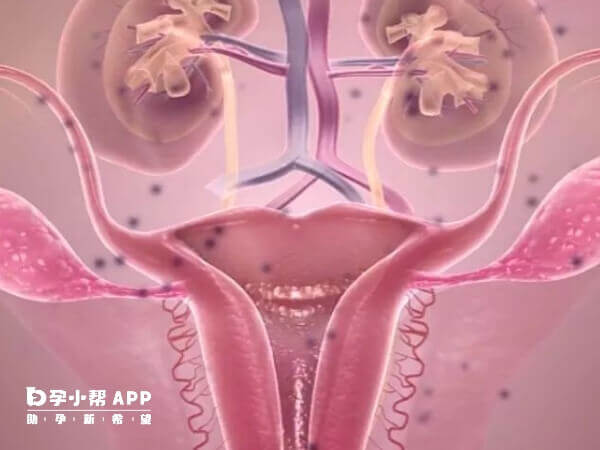 腹腔镜手术是治疗卵巢早衰的有效手段