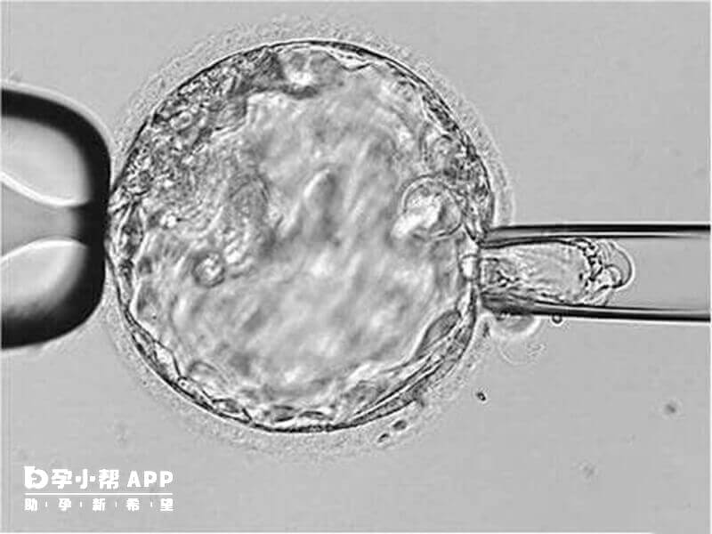 4bc囊胚移植成功率在20%-40%左右
