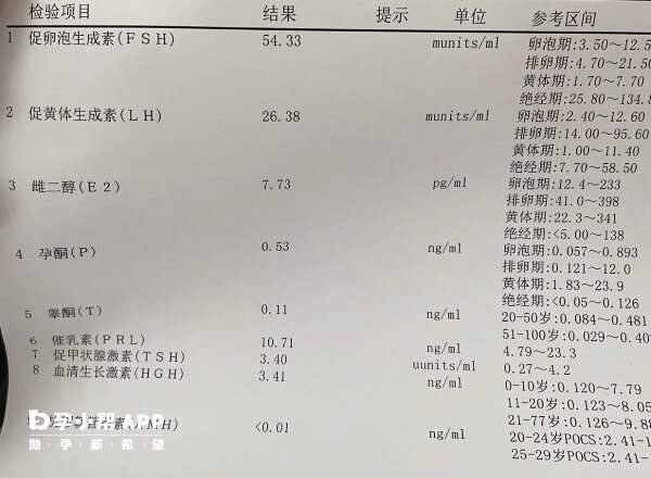 做amh检查前要提前了解清楚流程步骤