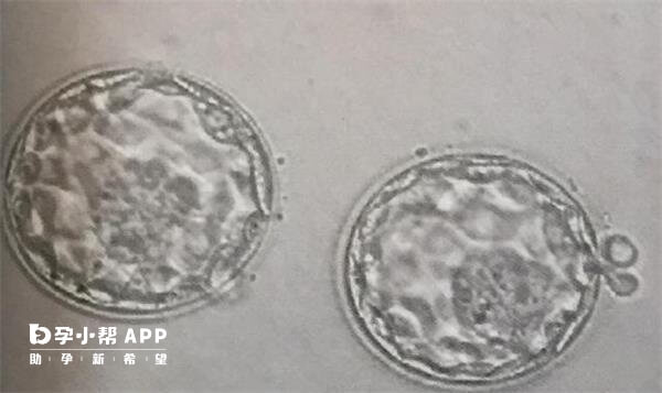 发育程度不同是4aa和6aa囊胚的区别之一