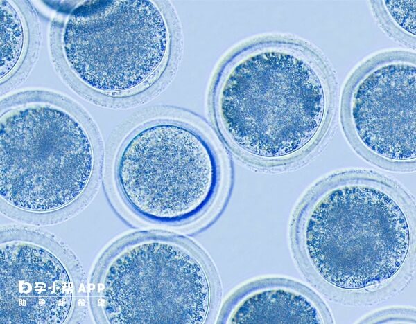 黏液质量是影响试管婴儿成功率
