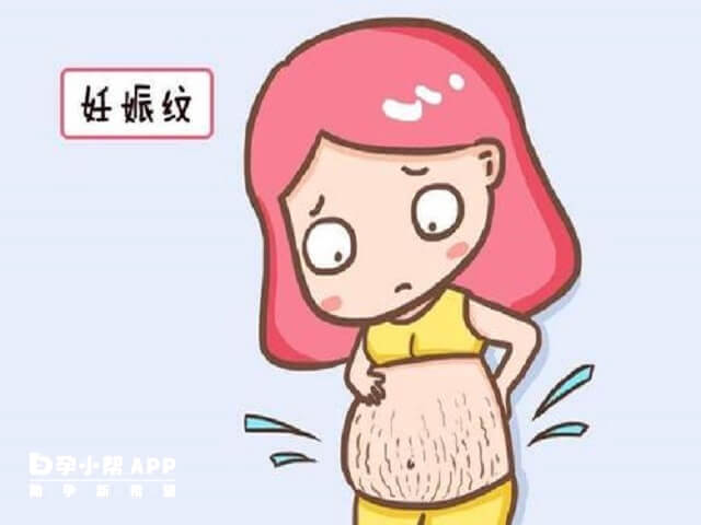 孕期妊娠纹一般在孕中晚期会出现