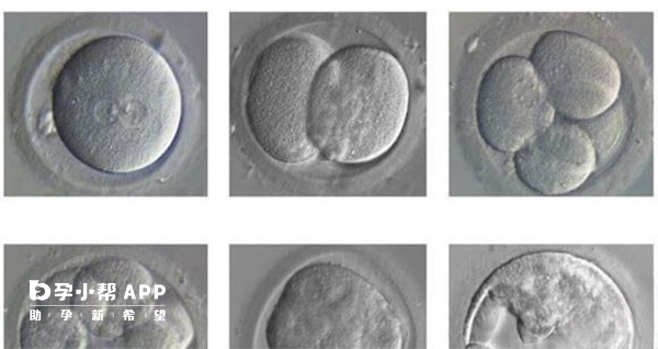 高龄做试管培养囊胚能降低流产风险