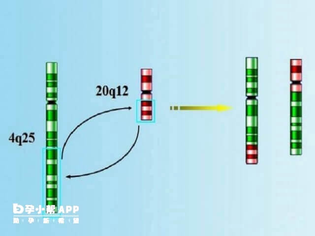 染色体平衡易位会影响生殖健康