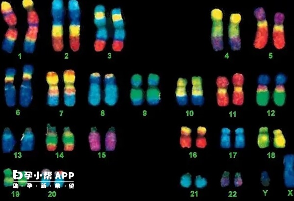 4号染色体异常会严重影响胎儿健康