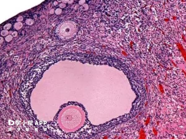空卵泡不治疗会导致取卵手术频频失败