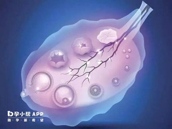 多囊患者促排前要确保输卵管通畅