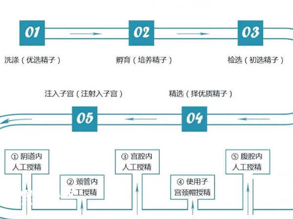 人工授精流程图