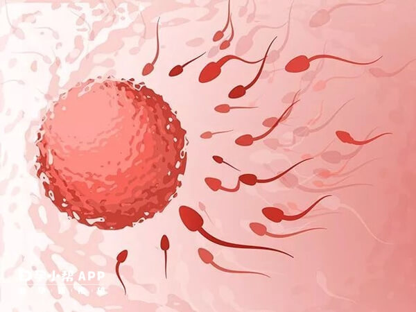 人工授精一般是指夫精宫腔内人工授精