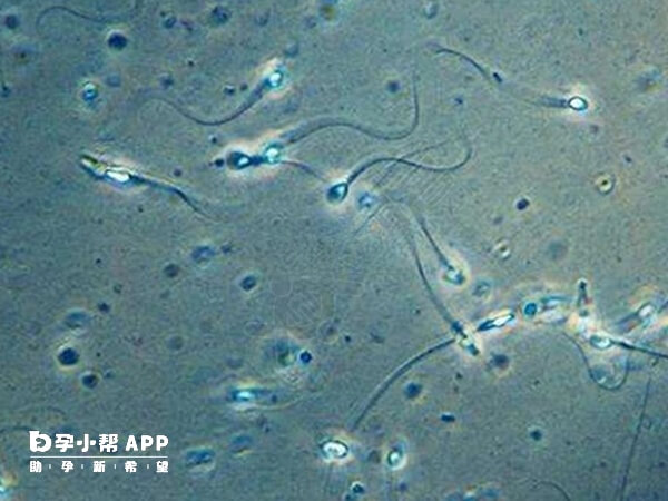 男性无精症很多是梗阻性可做手术治愈的