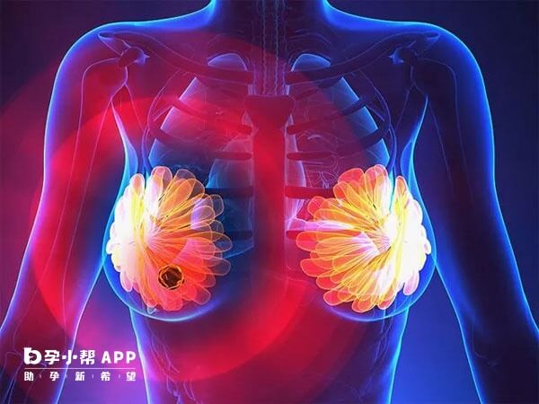 乳腺癌是目前全球女性恶性肿瘤的第1位