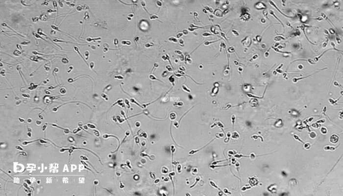弱精症可以做试管婴儿