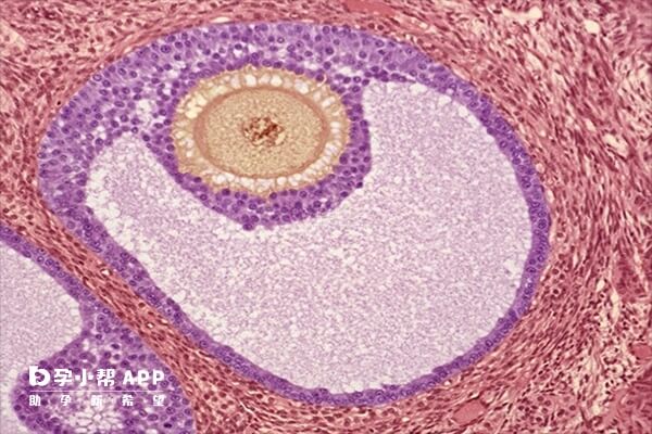 检查窦卵泡能帮助提升试管婴儿成功率
