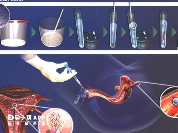 太原做人工授精的条件