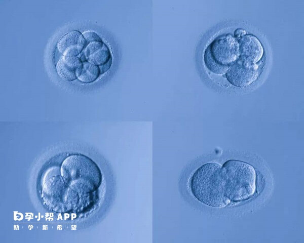 胚胎培养是三代试管的流程之一