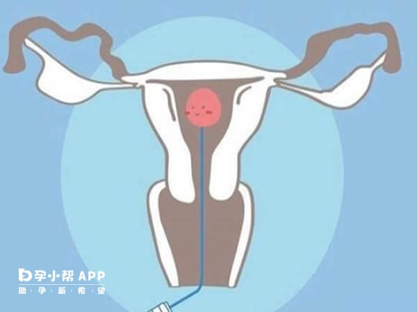 女性宫寒要引起重视积极治疗