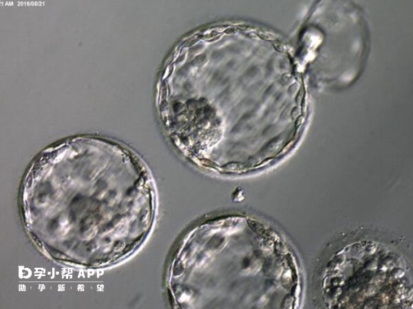 囊胚移植后去医院抽血验孕最准确