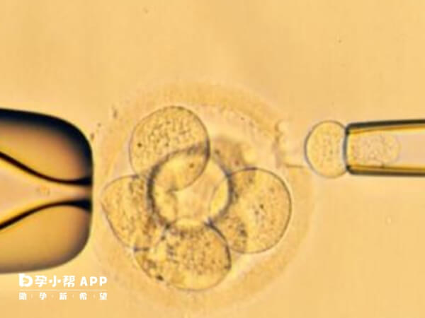 囊胚移植并非一定能成功