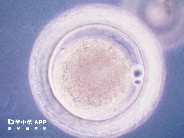 胚胎筛查能实现优生优育