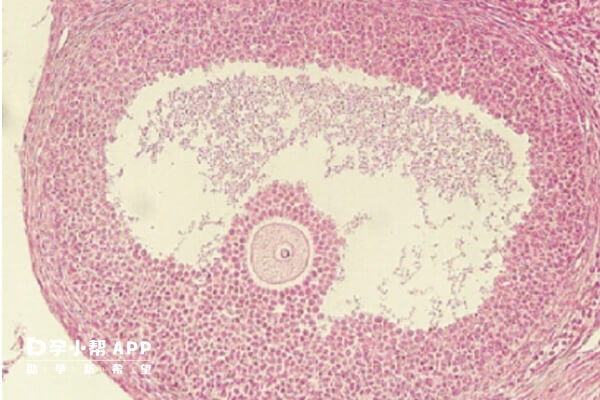 检查窦卵泡有助于评估女性卵巢功能