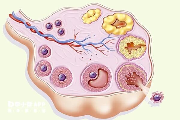 排卵障碍又叫不排卵