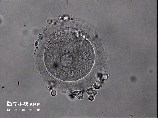 试管观察原核数能判断受精卵是否正常