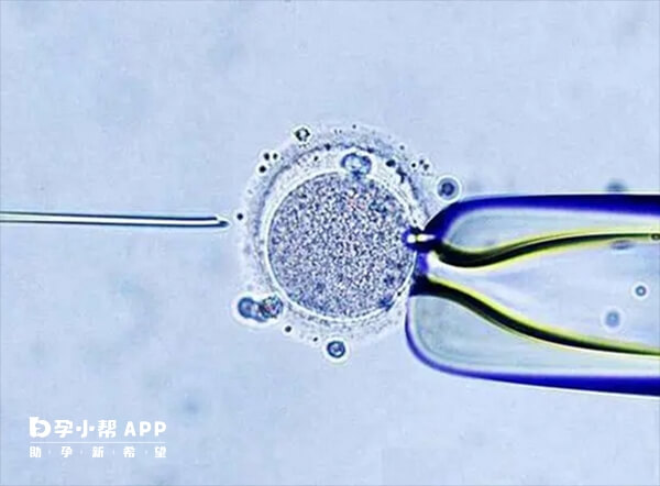囊胚移植后做好注意事项能提高成功率