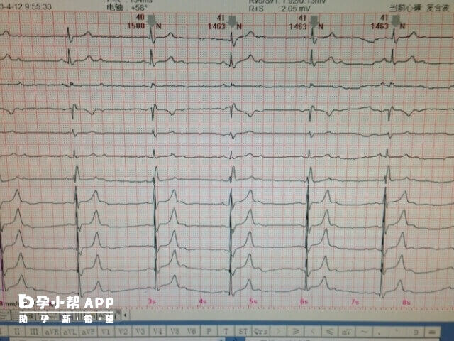 试管移植成功后要做心电图