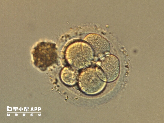 3bb囊胚移植成功率高