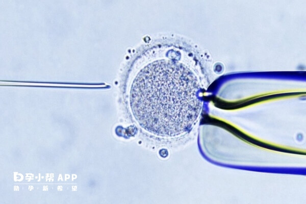 试管婴儿治疗期间先了解流程才能节约时间