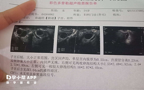 激素不正常会影响卵泡发育