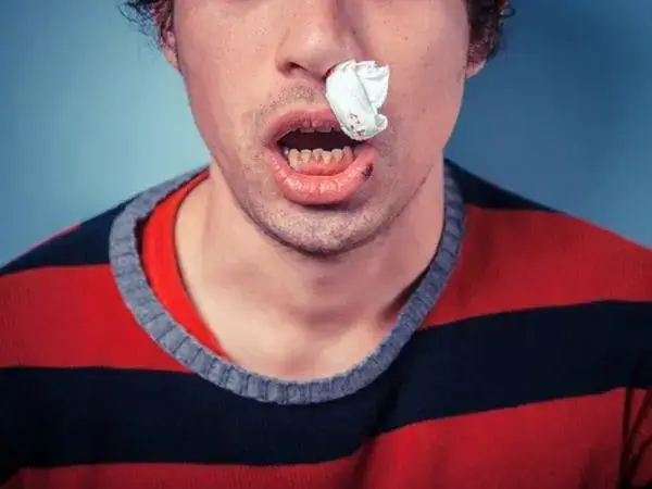 儿童流鼻血是属于一种比较常见的情况