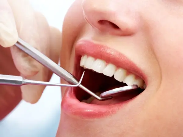 牙龈出血要注意及时治疗