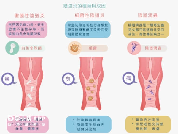不同类型阴道炎的症状表现
