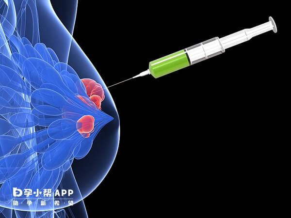 不良的生活习惯可能导致乳腺癌的发生