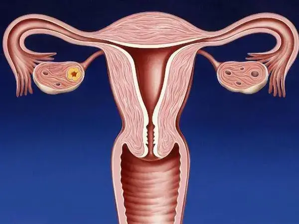 子宫内膜薄怀孕后容易引起流产