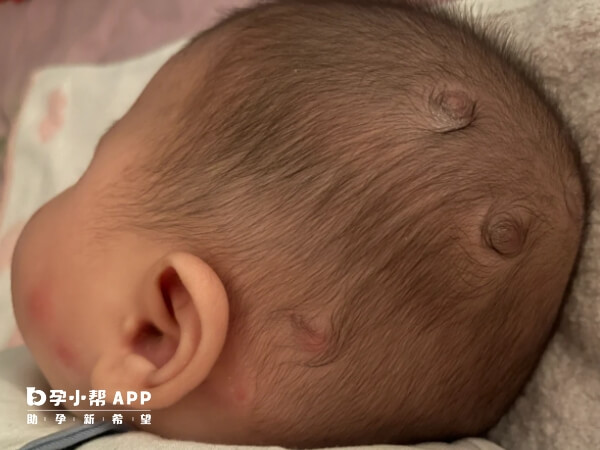 一胎宝宝发旋预示二胎性别