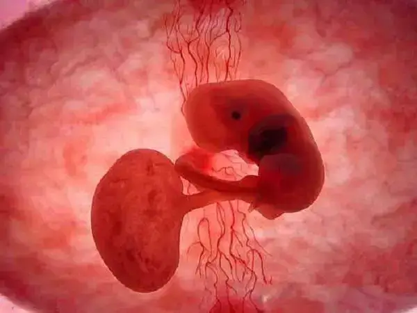 胎停大部分原因是染色体疾病引起