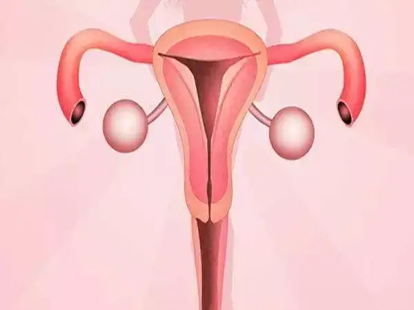 卵巢位置过高还可能引起输卵管堵塞