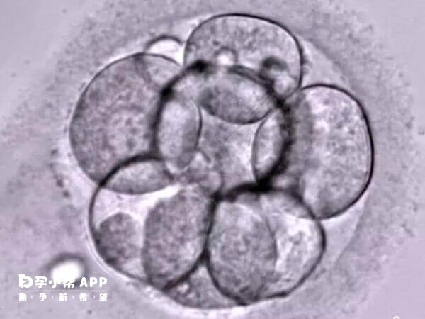 拮抗剂方案一般移植的都是冻胚