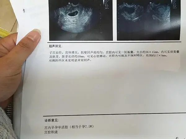 移植中出现宫腔积液要配合医生治疗