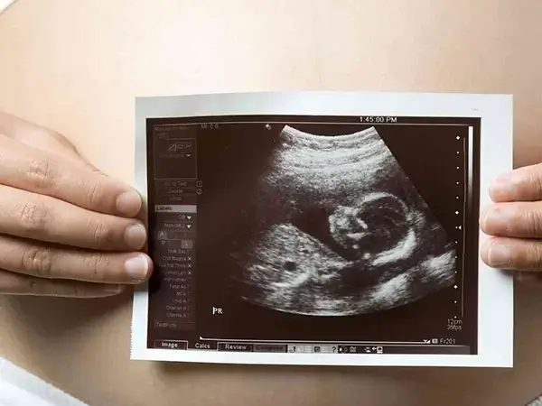 胚胎移植后长时间没看到孕囊可能是宫外孕