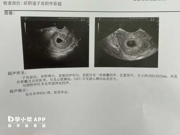 内膜窗口期移植成功率高