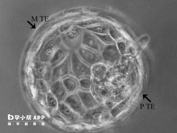 囊胚培养要求的条件高