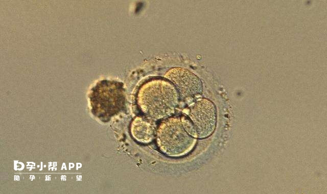试管婴儿攒胚胎可提高成功率